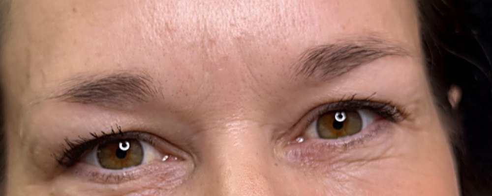 COMBO BROWS: Augenbrauen vorher